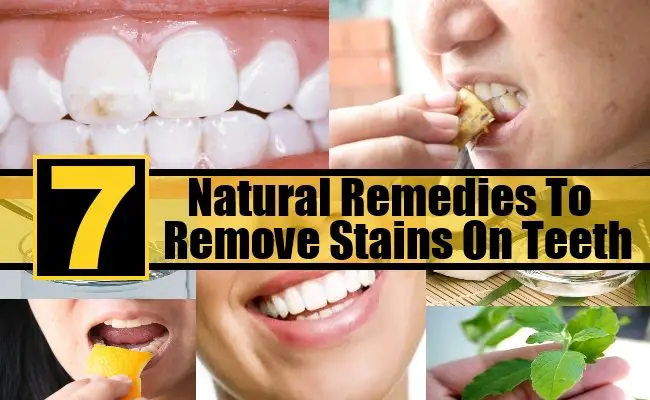 7 Natural Remedies To Remove Stains On Teeth
