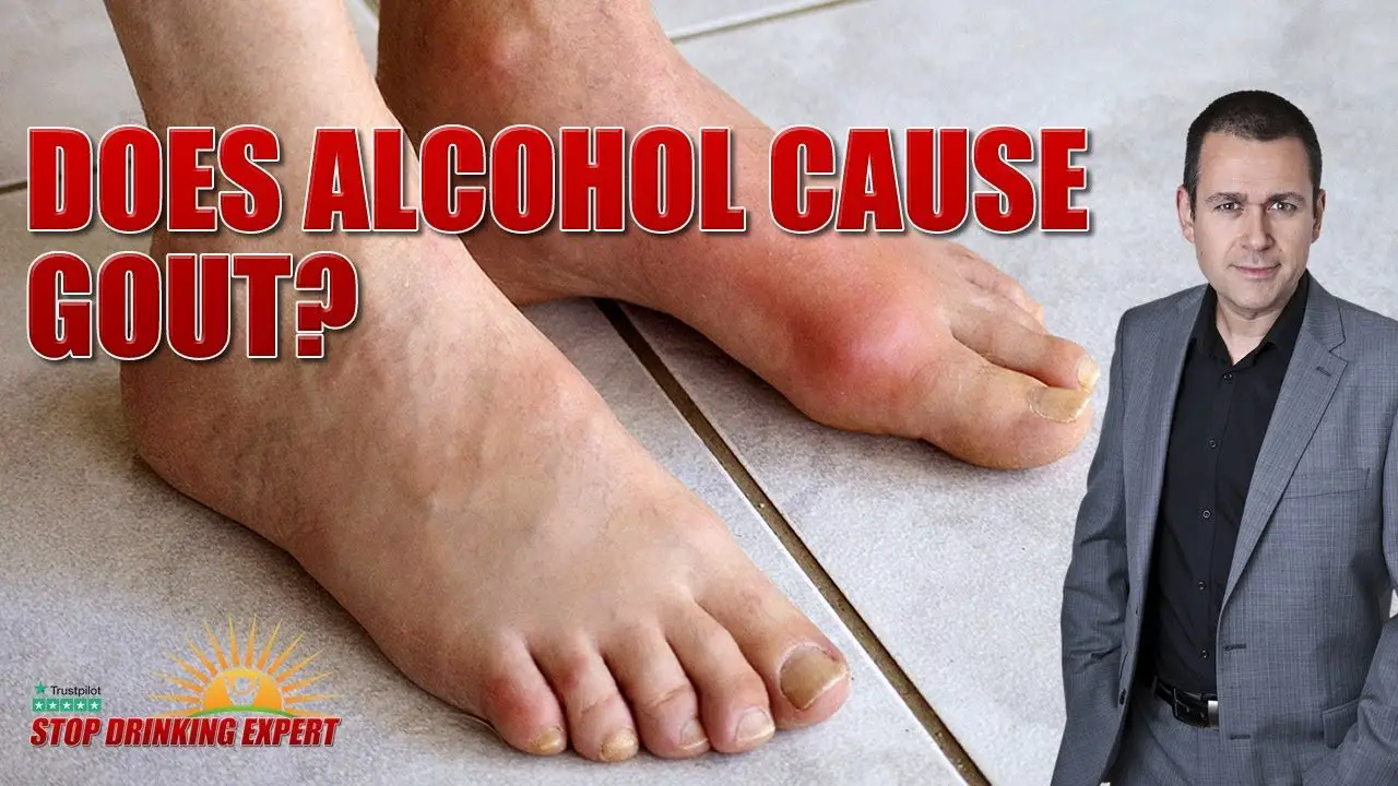 Does Alcohol Cause Gout?